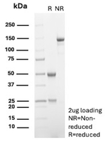 RET Proto-oncogene (Medullary Thyroid Carcinoma Marker) Antibody in SDS-PAGE (SDS-PAGE)