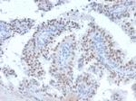 RET Proto-oncogene Monoclonal Antibody (RET/2663)