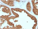 RET Proto-oncogene Monoclonal Antibody (RET, 2795)
