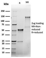 Bcl-X (Apoptosis Marker) Monoclonal Antibody (rBCL2L1/4508)