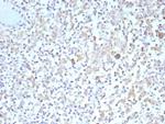 Bcl-X (Apoptosis Marker) Recombinant Rabbit Monoclonal Antibody (BCL2L1/9221R)