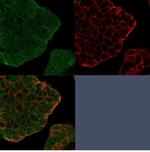 BCL2-like 2 (BCL2L2)/BCL-W Monoclonal Antibody (PCRP-BCL2L2-1A4)