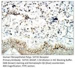 5HT2C Receptor Polyclonal Antibody