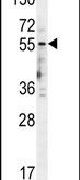 HTR3E Antibody in Western Blot (WB)