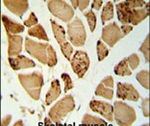 NT5C1A Antibody in Immunohistochemistry (IHC)