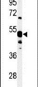 NT5C1A Antibody in Western Blot (WB)
