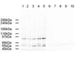 AP2A Polyclonal Antibody