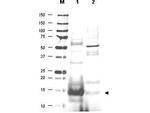 UBC13 Polyclonal Antibody