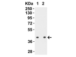 Avian Influenza Hemagglutinin 4 Polyclonal Antibody