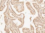 Mash1/Ascl1 Polyclonal Antibody