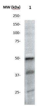 AKT3/PKBg Antibody in Western Blot (WB)