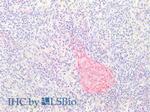 Collagen Type III Antibody in Immunohistochemistry (Paraffin) (IHC (P))