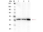 beta Amyloid Antibody in Western Blot (WB)