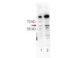 Phospho-NFkB (Ser276) Polyclonal Antibody