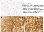 Phospho-Myosin (Ser19, Ser20) Antibody in Immunohistochemistry (Paraffin) (IHC (P))