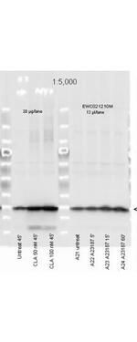 Phospho-Myosin (Ser19, Ser20) Antibody in Western Blot (WB)