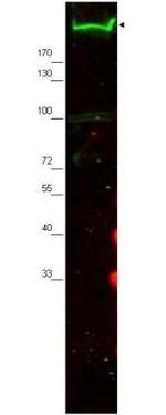 Nestin Antibody in Western Blot (WB)
