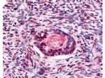 Phospho-GSK3 beta (Ser9) Polyclonal Antibody