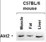 AKT2 Polyclonal Antibody