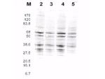 RFA2 Polyclonal Antibody