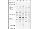 UBP43 Polyclonal Antibody