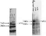 PC2 Antibody in Western Blot (WB)