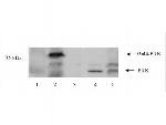 PNK Polyclonal Antibody