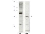 HUS1B Polyclonal Antibody