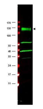 FANCA Polyclonal Antibody