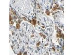 FANCG Polyclonal Antibody