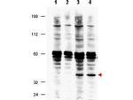 FANCF Polyclonal Antibody