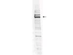 WHIP Polyclonal Antibody