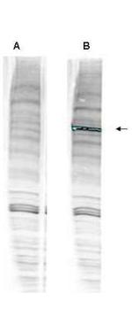 WHIP Antibody in Western Blot (WB)