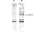 RAD52 Antibody in Western Blot (WB)