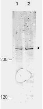 Phospho-APC1 (Ser377) Antibody in Western Blot (WB)