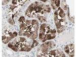 Cbl-c Antibody in Immunohistochemistry (Paraffin) (IHC (P))