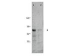BORIS Polyclonal Antibody