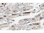 iASSP Polyclonal Antibody