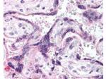 Phospho-EGFR (Tyr1197) Polyclonal Antibody