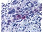 Phospho-MLF1 (Thr78) Antibody in Immunohistochemistry (Paraffin) (IHC (P))
