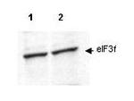 EIF3F Polyclonal Antibody