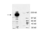 Cas5 Polyclonal Antibody