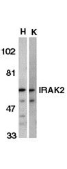 IRAK2 Antibody in Western Blot (WB)