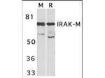 IRAK-M Antibody in Western Blot (WB)