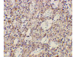 TLR2 Antibody in Immunohistochemistry (Paraffin) (IHC (P))