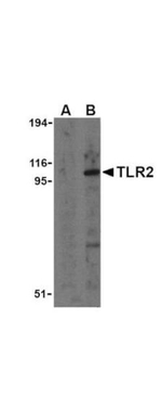 TLR2 Antibody in Western Blot (WB)