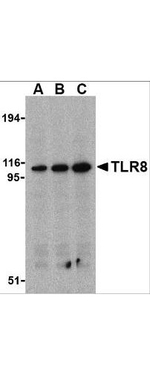 TLR8 Antibody in Western Blot (WB)
