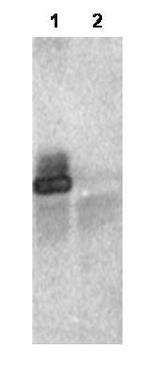 RNF25 Antibody in Western Blot (WB)