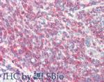 Sipa1 Antibody in Immunohistochemistry (Paraffin) (IHC (P))
