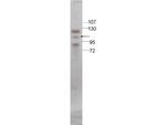 Stat5 Polyclonal Antibody